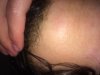 hairline 1.jpg hairline 1.jpg