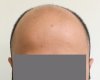 Case 1. before-1.jpg