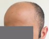 Case 1. before-2.jpg