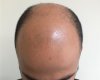 Case 1. before-4.jpg