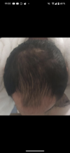 1000204185.png