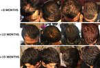 IMP masaje y crece cabello.jpg