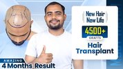 Karan Sahu's Incredible Hair Transformation at Hairfree & Hairgrow, Bhopal.jpeg