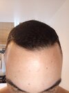 IMG_20250412_084225906_MFNR.jpg