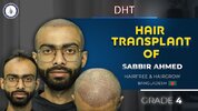 Sabbir Ahmed’s Hair Restoration Journey.jpg