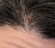 gash-on-head-from-injury-can-it-cause-permanent-hair-loss-v0-7lgtebvdj23f1.jpg