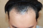 before (1).jpg before (1).jpg