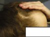 8,5 months results.jpg 8,5 months results.jpg