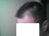 before.JPG