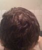 top-dry-before.jpg