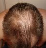 Hair91209.jpg