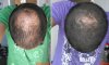 before+aftahh.jpg