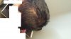 Side of my Head Sept. 27 2015.jpg Side of my Head Sept. 27 2015.jpg