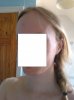 PT hairline.jpg PT hairline.jpg