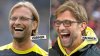 bild-hair-transplant-972976033.jpg