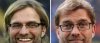 klopp hair.jpg