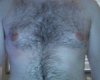 gyno.jpg