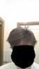 hairloss1.jpg
