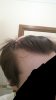 hairloss5.jpg