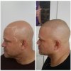 my side before after.jpg