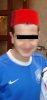 hairline3.jpg hairline3.jpg