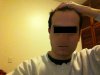 Balding.jpg Balding.jpg