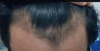 post.png