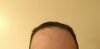 forehead far.jpg forehead far.jpg