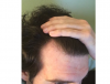 3.PNG