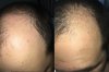 Before and After 2.5 Months Left.jpg