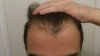 hairlr.jpg hairlr.jpg