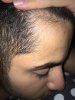 1 Month on Rogain.jpg