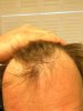 hair line crop.jpg hair line crop.jpg