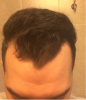 hair 1.png hair 1.png