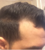 hair 2.png hair 2.png