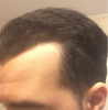 hair 3.png hair 3.png