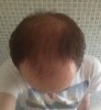 Hair-top.jpg