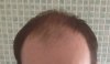 Hair-front.jpg