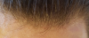 frontregrowth3.png