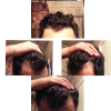 HAIR.png