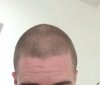 hairine.jpg