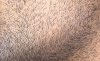 after rubbing ginger juice for 3 months.jpg