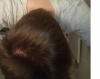 balding 2.png