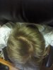 balding 3.jpg