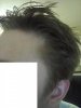 balding 4.jpg