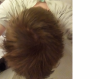 balding 6.png