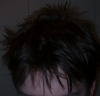 balding 7.png
