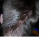 balding 9.png