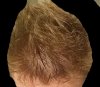 Before.jpg Before.jpg