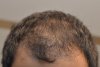 Hairline.jpg